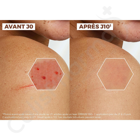 A-Derma Epithéliale Ultra Repair - Crème 40 ml