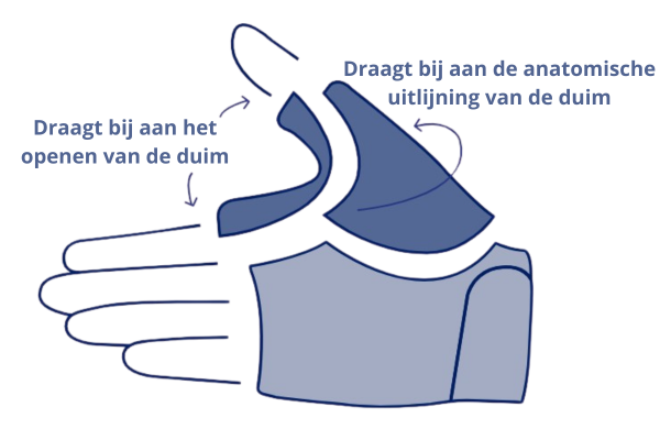 thuasne-systeme-tensionstrap-nl